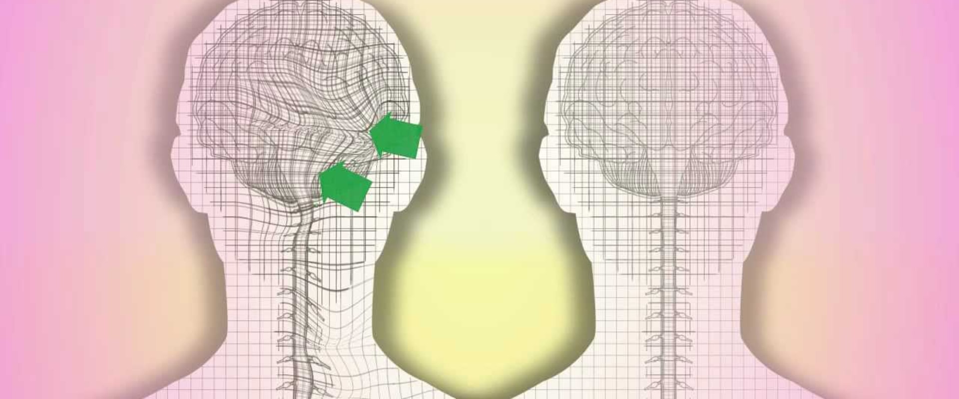 Craniosacral Therapy Techniques: An Overview