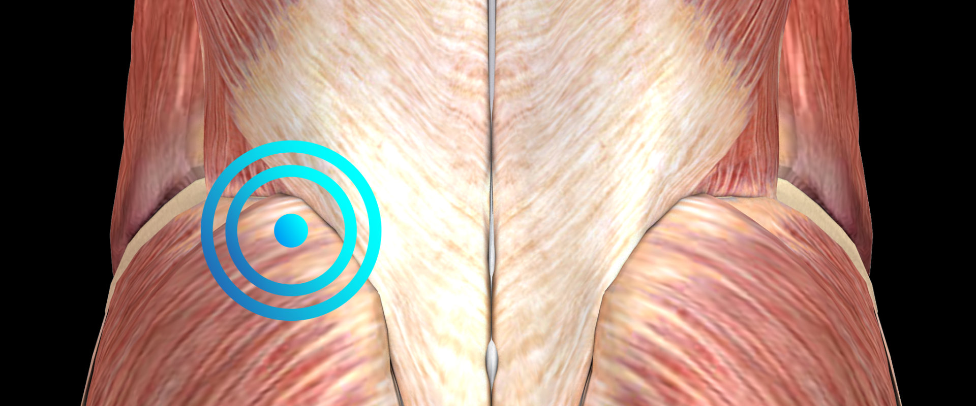 Myofascial Trigger Point Release Techniques for Pain Relief