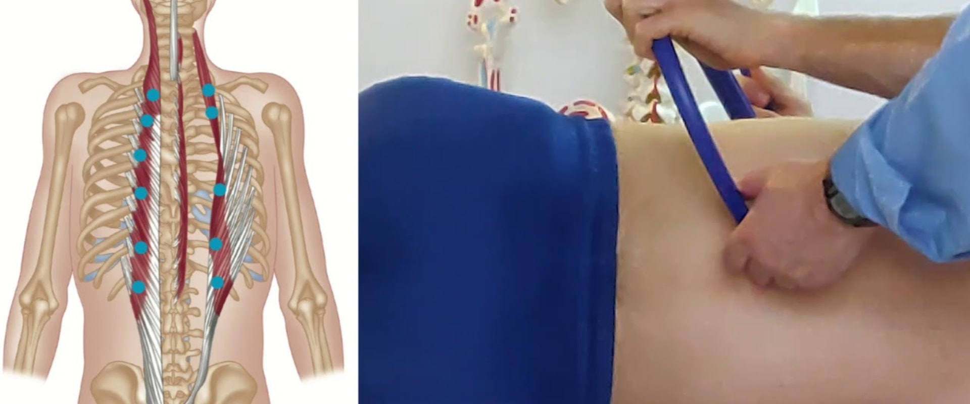 Trigger Point Release Techniques for Pain Relief