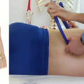 Trigger Point Release Techniques for Pain Relief