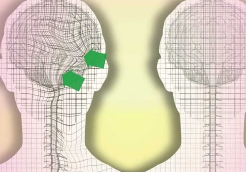 Craniosacral Therapy Techniques: An Overview