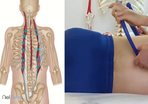 Trigger Point Release Techniques for Pain Relief